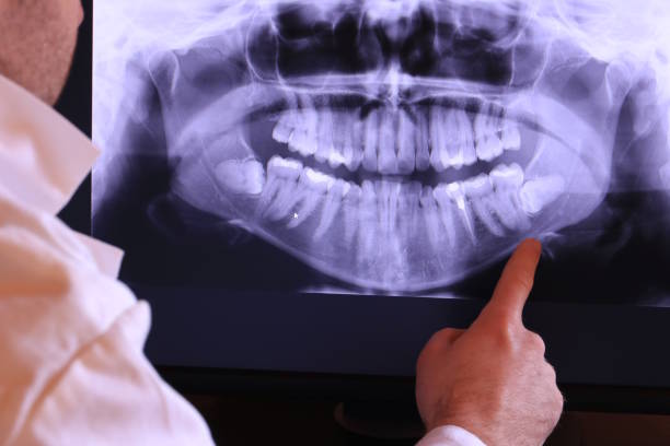 Best Emergency Denture Repair in Kaukauna, WI